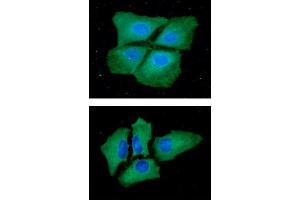 ICC/IF analysis of PKLR in Hep3B cells line, stained with DAPI (Blue) for nucleus staining and monoclonal anti-human PKLR antibody (1:100) with goat anti-mouse IgG-Alexa fluor 488 conjugate (Green).