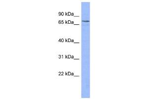 WB Suggested Anti-PATZ1  Antibody Titration: 0. (PATZ1 anticorps  (N-Term))