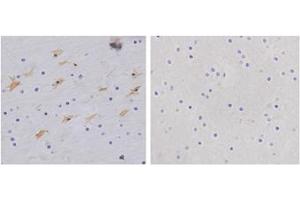 Immunohistochemistry analysis of human brain tissue slide (Paraffin embedded) using Rabbit Anti-GFAP Polyclonal Antibody (Left, ABIN398827) and Purified Rabbit IgG (Whole molecule) Control (Right, ABIN398653) (GFAP anticorps  (AA 250-300))