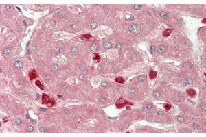 Detection of CHI3L1 in Human Liver Tissue using Polyclonal Antibody to Chitinase-3-like Protein 1 (CHI3L1) (CHI3L1 anticorps  (AA 112-377))