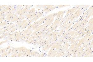 Detection of CRN in Human Cardiac Muscle Tissue using Polyclonal Antibody to Corin (CRN)