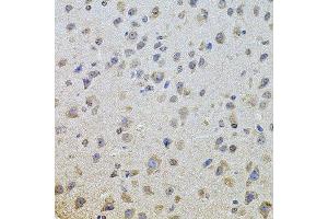 Immunohistochemistry of paraffin-embedded mouse brain using EGFR antibody. (EGFR anticorps  (AA 1021-1210))