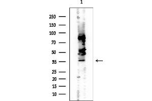 anti-Testis Expressed 264 (TEX264) antibody