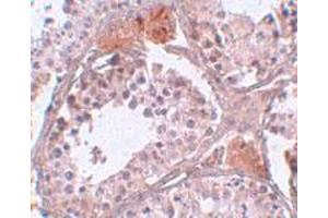 Immunohistochemical staining of human testis tissue with 5 ug/mL C4 or f35 polyclonal antibody . (CABS1 anticorps  (C-Term))