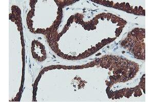Immunohistochemical staining of paraffin-embedded Human breast tissue using anti-C20orf3 mouse monoclonal antibody. (APMAP anticorps)