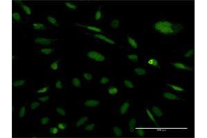Immunofluorescence of monoclonal antibody to EXOSC5 on HeLa cell. (EXOSC5 anticorps  (AA 1-235))