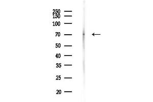 anti-Carnitine O-Acetyltransferase (CRAT) (Internal Region) antibody