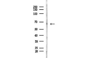 Western blot analysis of lysates from Hela cells(heat-shock, 45 min treatment), using Phospho-NF-kB p65 (Ser276) Antibody at 1/1000 dilution.