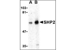 Western blot analysis of SHP2 in mouse skeletal muscle tissue lysate with this product at (A) 0. (PTPN11 anticorps  (N-Term))