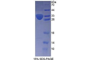 SDS-PAGE analysis of Human KTN1 Protein.