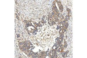 IHC analysis of SNPH using anti-SNPH antibody (ABIN7601724). (Syntaphilin anticorps  (AA 43-482))