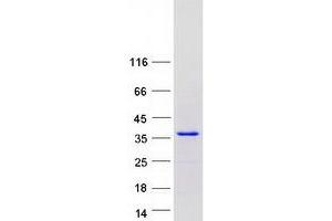 Validation with Western Blot