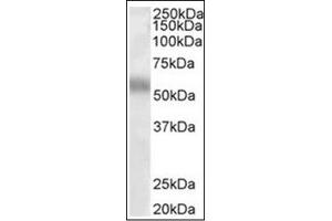 Image no. 1 for anti-Transcription Factor EB (TFEB) (Internal Region) antibody (ABIN374974) (TFEB anticorps  (Internal Region))
