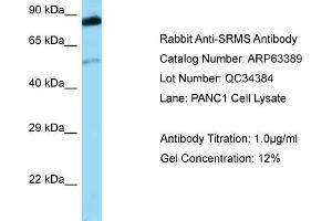 Western Blotting (WB) image for anti-Src-Related Kinase Lacking C-Terminal Regulatory Tyrosine and N-Terminal Myristylation Sites (SRMS) (Middle Region) antibody (ABIN2789479) (SRMS anticorps  (Middle Region))