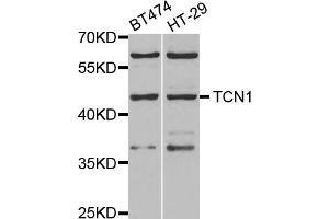 Western blot analysis of extracts of various cell lines, using TCN1 antibody. (TCN1 anticorps)