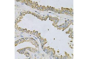 Immunohistochemistry of paraffin-embedded human prostate using APRT Antibody. (APRT anticorps  (AA 1-180))