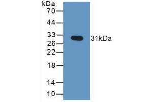 Detection of Recombinant GZMB, Human using Polyclonal Antibody to Granzyme B (GZMB) (GZMB anticorps  (AA 21-247))