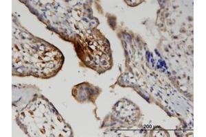 Image no. 1 for anti-Wingless-Type MMTV Integration Site Family, Member 5A (WNT5A) (AA 201-301) antibody (ABIN599464)