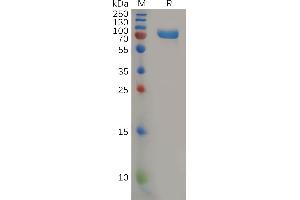 Human CD112 Protein, mFc Tag on SDS-PAGE under reducing condition.