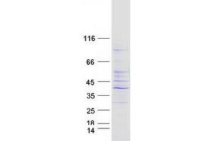 Validation with Western Blot