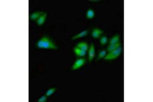 Immunofluorescent analysis of Hela cells using ABIN7154751 at dilution of 1:100 and Alexa Fluor 488-congugated AffiniPure Goat Anti-Rabbit IgG(H+L) (GNL1 anticorps  (AA 251-500))