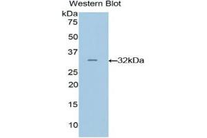 Western blot analysis of the recombinant protein. (GRAP2 anticorps  (AA 20-262))