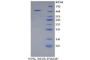 SDS-PAGE analysis of Rat FABP6 Protein.