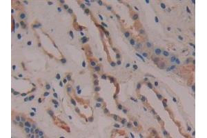 Detection of COX 2 in Human Kidney Tissue using Polyclonal Antibody to Cyclooxygenase-2 (COX 2)