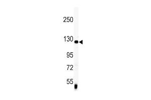 Western blot analysis of anti-Vinculin Antibody (C-term) (ABIN391626 and ABIN2841546) in mouse lung tissue lysates (35 μg/lane).