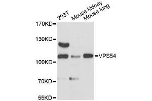 Western blot analysis of extracts of various cell lines, using VPS54 antibody (ABIN6293850) at 1:3000 dilution. (VPS54 anticorps)