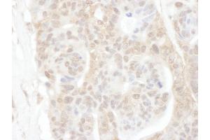 anti-ROC1 (AA 1-50) antibody