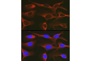 Immunofluorescence analysis of U2OS cells using WNK3 Rabbit pAb (ABIN7271382) at dilution of 1:200 (40x lens).