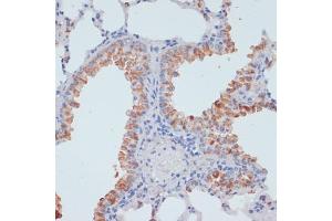 Immunohistochemistry of paraffin-embedded rat liver using SLC39 antibody (ABIN1682781, ABIN3017803, ABIN3017805 and ABIN6220263) at dilution of 1:100 (40x lens). (SLC39A4 anticorps  (AA 23-327))