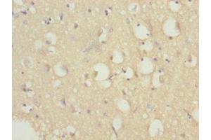 Immunohistochemistry of paraffin-embedded human brain tissue using ABIN7164431 at dilution of 1:100 (HERC6 anticorps  (AA 764-1022))