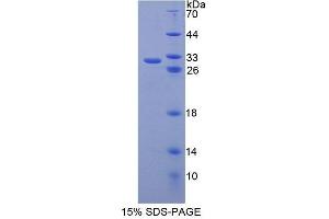 Image no. 1 for ATP-Binding Cassette, Sub-Family B (MDR/TAP), Member 6 (ABCB6) (AA 590-842) protein (T7 tag,His tag) (ABIN6239290)