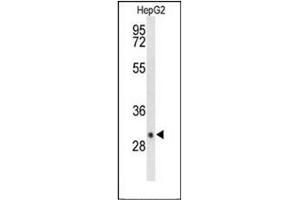Western blot analysis of DIO3 Antibody (C-term) in HepG2 cell line lysates (35ug/lane).