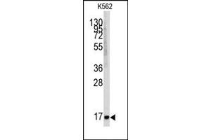 Image no. 1 for anti-Microsomal Glutathione S-Transferase 1 (MGST1) (Center) antibody (ABIN357900)
