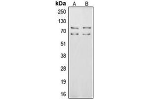 Western blot analysis of Vitronectin expression in MCF7 (A), HepG2 (B) whole cell lysates. (Vitronectin anticorps  (Center))