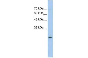 GSTM1 antibody used at 1 ug/ml to detect target protein. (GSTM1 anticorps  (N-Term))