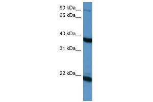 Pleiotrophin antibody used at 1 ug/ml to detect target protein. (Pleiotrophin anticorps)