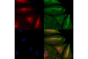 ABIN6259273 and ABIN6273655 staining  cells by IF/ICC. (FIL1h anticorps  (C-Term))