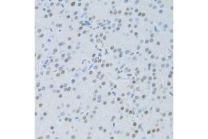 Immunohistochemistry of paraffin-embedded rat pancreas using SNRNP70 antibody.