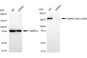 Western blotting analysis using Clathrin heavy chain antibody (ABIN7798090). (Recombinant Clathrin Heavy Chain (CLTC) anticorps)