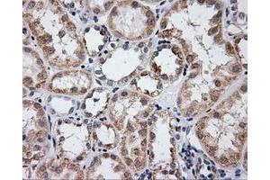 Immunohistochemical staining of paraffin-embedded liver tissue using anti-LIPG mouse monoclonal antibody. (LIPG anticorps)