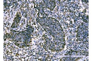 IHC analysis of KPNA2 using anti-KPNA2 antibody (ABIN7601936).