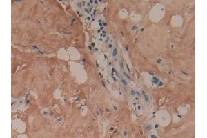 Detection of COL1a1 in Human Mammary gland Tissue using Polyclonal Antibody to Collagen Type I Alpha 1 (COL1a1)