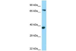 WB Suggested Anti-FYB Antibody Titration: 1. (FYB anticorps  (N-Term))