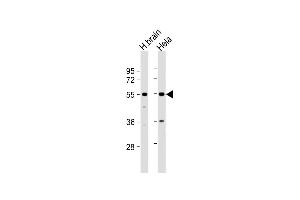 All lanes : Anti-TFG Antibody (Center) at 1:1000 dilution Lane 1: human brain lysate Lane 2: Hela whole cell lysate Lysates/proteins at 20 μg per lane. (TFG anticorps  (AA 85-114))