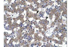 Image no. 1 for anti-Dachshund 2 (DACH2) (AA 525-574) antibody (ABIN6735937)