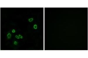 Immunofluorescence analysis of A549 cells, using BRP44L Antibody. (BRP44L anticorps  (AA 11-60))